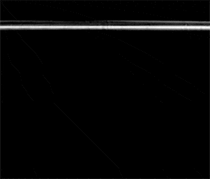  OCT断層画像（無償対応）